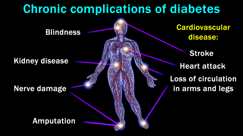 Diabetes is Considered as Mother of All Diseases - YogaTute Health